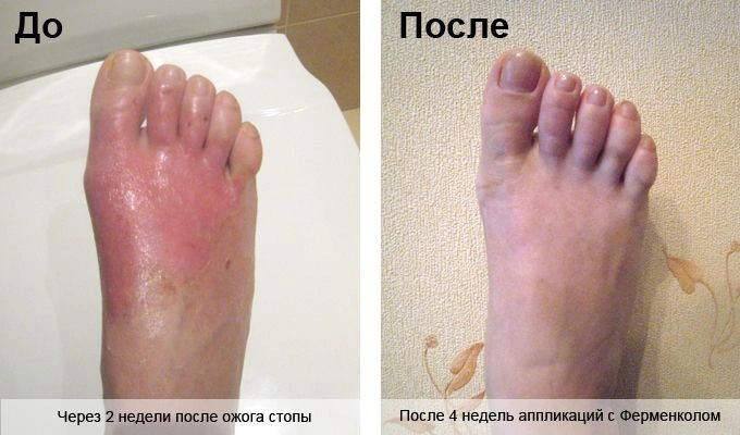 КОРРЕКИЯ РУБА