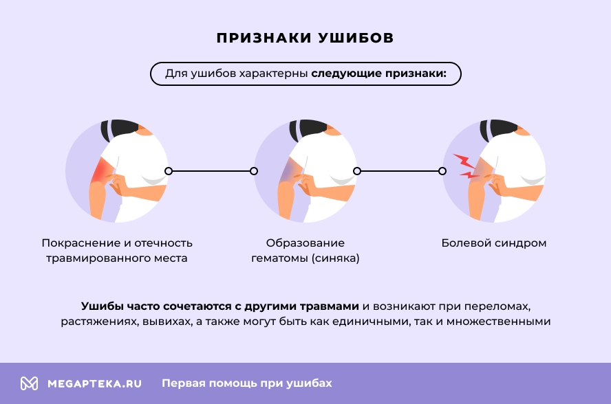 ПЕРЕВАЯ ПРОМОТА