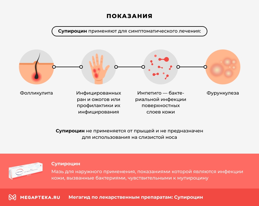 Сюпирсин инпракхия Перинуни,