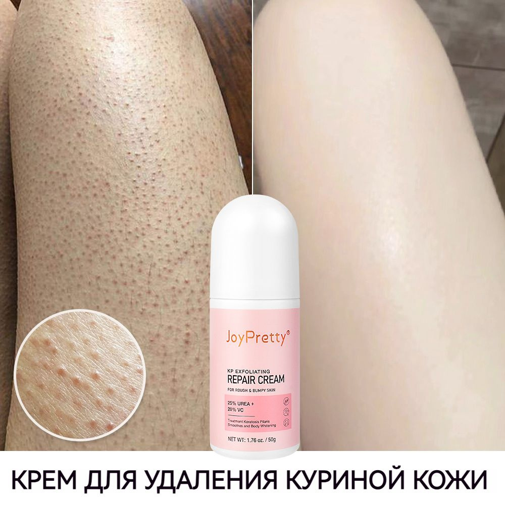Кррет -телаз 