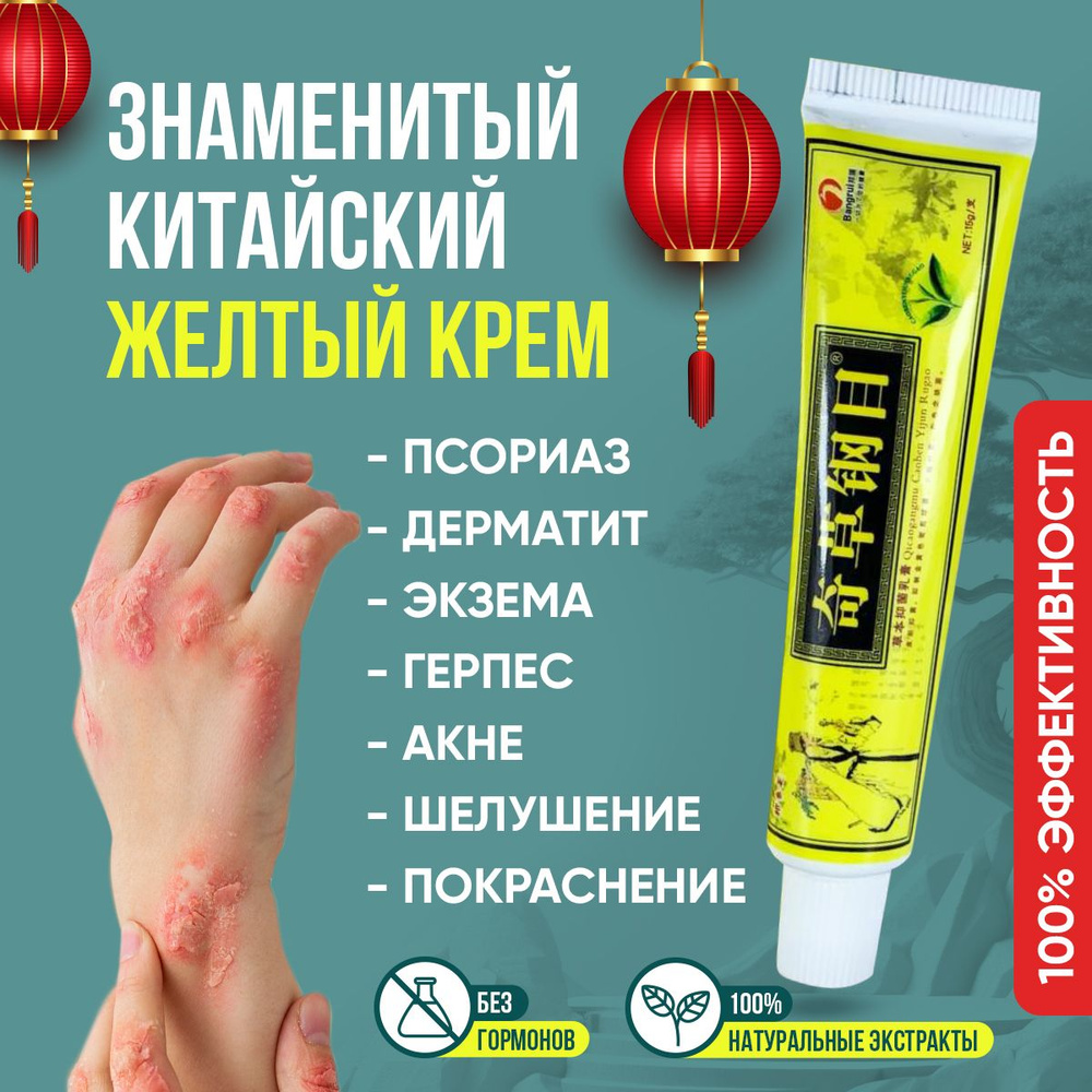Maзa-kremem otpsoriaзa, эkemы, otopyчeskogogo dermatyta / kiotaйskay
